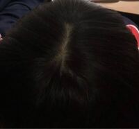 中学生女子です このつむじ 禿げていますか Yahoo 知恵袋