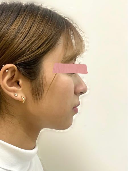 画像の鼻横にある線は頬肉なのでしょうか それとも頬骨ですか Yahoo 知恵袋