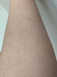 こんにちは悩みがあります 高校生なのですが めちゃくちゃ毛が濃いです 生きて Yahoo 知恵袋