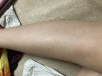 汚い画像あり女なのにほんとに毛深すぎて困ってます泣中一でも買え Yahoo 知恵袋