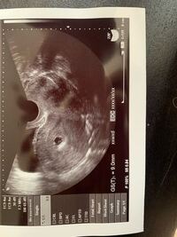 おそらく5w3dです 先程クリニックにて胎嚢確認をしました 先生からは Yahoo 知恵袋