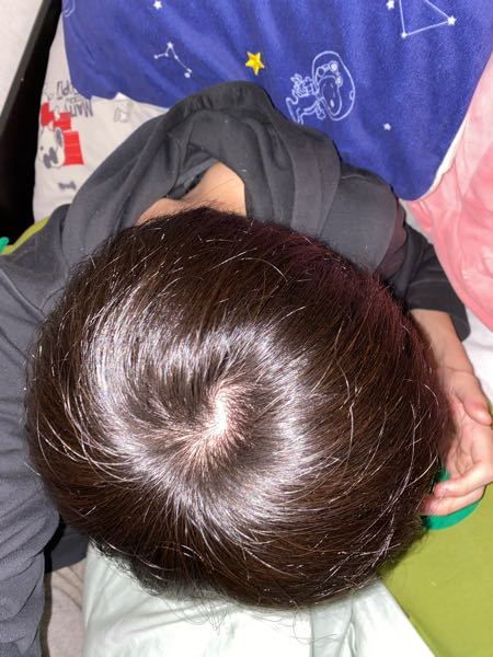 このつむじはつむじハゲですか Yahoo 知恵袋