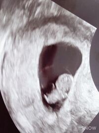 現在 妊娠8週目に入りましたがこの画像で性別は何となくでもいいのですが分かる Yahoo 知恵袋