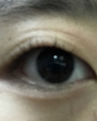 まぶた伸びました どうしたら治りますか 整形以外でお願いします Yahoo 知恵袋