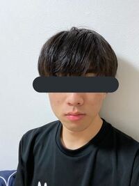左側のエラだけ張っていて右側は張っていません なので顔が歪んで Yahoo 知恵袋