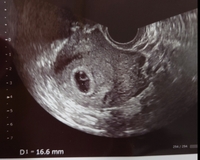 先週検診に行ってきたところ 胎嚢は確認でき画像の通り16 6mmでした Yahoo 知恵袋