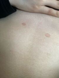 スプレー に変わる ハチ お腹 の シミ 死すべき ブリード ピンチ