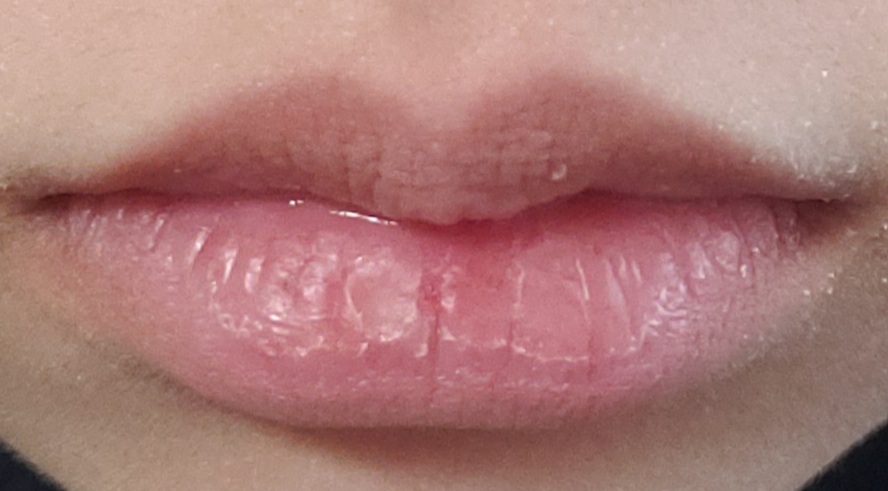 閲覧注意 下唇の乾燥が治らない 寝る前と出かける前にヴァセリンを Yahoo 知恵袋