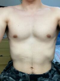 質問です 今度 医療脱毛をするのですが この腹毛の場合 下半 Yahoo 知恵袋