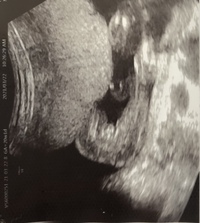 妊娠週のエコー写真です 性別がそろそろ分かる時期になったと思うので Yahoo 知恵袋