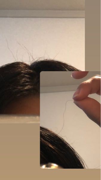 元々直毛なのに ここ最近髪の毛が陰毛みたいにチリチリになって生えてくるのです Yahoo 知恵袋