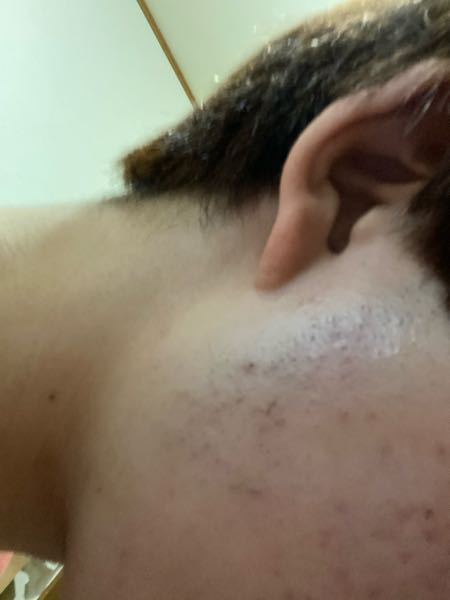 ハイチオールcプラス ハイチオールcホワイティアって 飲むと本当に Yahoo 知恵袋