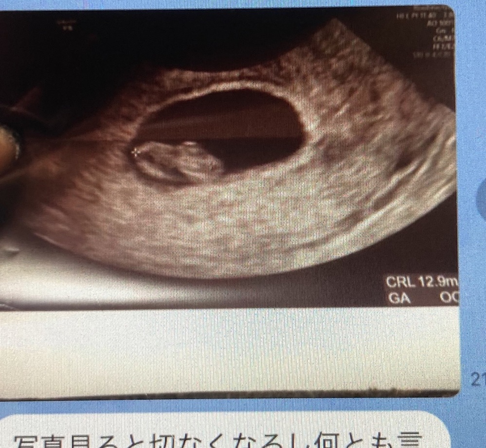 妊娠 出産 投票受付中の質問 Yahoo 知恵袋