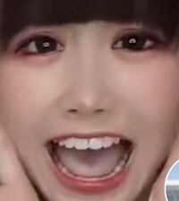 なんでこんなに舌白いんですか 心配ですし 気になったので質問いたし Yahoo 知恵袋