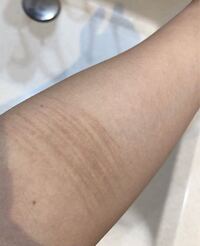 汚い画像すみません 薄くリストカットをしてたんですが跡が色素沈着しちゃって Yahoo 知恵袋