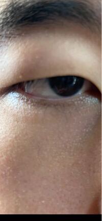 男ですが整形で目を変えたいです ブサイクな男子大学生です かなりブサイ Yahoo 知恵袋