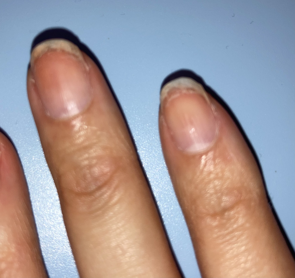 亜鉛サプリ 身長を伸ばすために亜鉛サプリを飲んでいるのですが 亜鉛 Yahoo 知恵袋