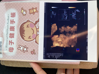 27週と6日の4dエコーの写真なのですが鼻がどこかおかしいように見 Yahoo 知恵袋