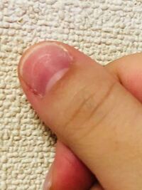 手が元々小さくその中でも5本指の中でも親指が幅広く 他4本は小さいです Yahoo 知恵袋
