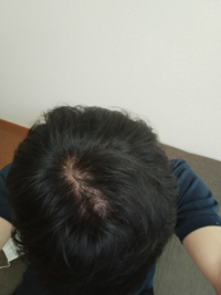 つむじの数って最高何個ですか 二つあります 恥じることではないですよね Yahoo 知恵袋