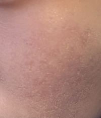 汚い写真失礼致します Diorのコンシーラーを使ってるのですがどう Yahoo 知恵袋