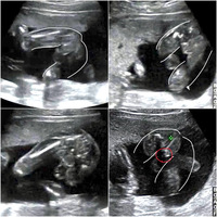 週のエコー写真ですこの4枚のエコー写真を見ると 性別は男女どち Yahoo 知恵袋