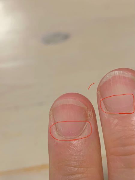 子供の頃から 写真の赤で囲った部分のように爪の根元から2mm程上の Yahoo 知恵袋