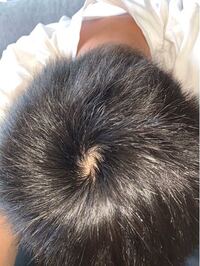 これはつむじハゲですか 今は短髪なんですが 前は長髪だったの Yahoo 知恵袋