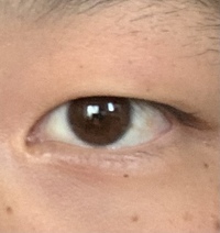 自分は昔からずっと重い一重なんですけど パッチリ丸い二重にするには Yahoo 知恵袋