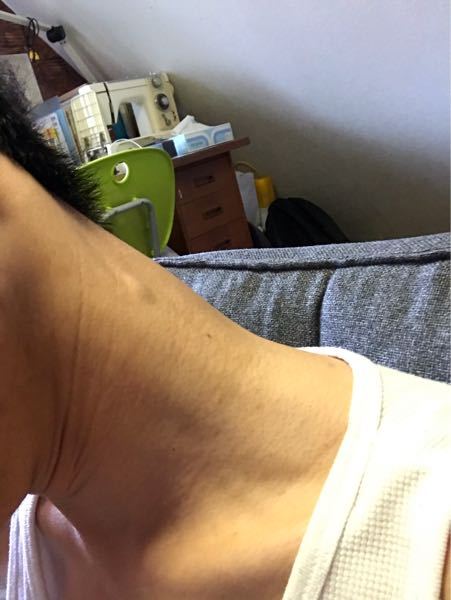 首にしこりがあります。硬いです。これは悪性ですか？ - Yahoo!知恵袋