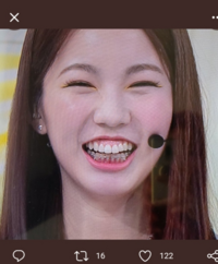 ガミースマイルってマイナスイメージがあるんですか 私はガミース Yahoo 知恵袋