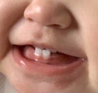 生後9ヶ月半の赤ちゃんについてです 乳歯が上の歯が4本 下の歯が2本生えてき Yahoo 知恵袋