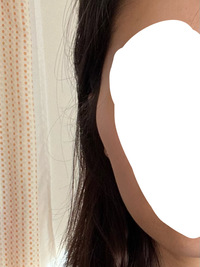 頬骨が横に出ていて目立ちます 元々も出ていて気になってはいました Yahoo 知恵袋