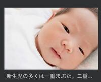 私の目はこの写真の赤ちゃんのように白目がほとんど見えないです Yahoo 知恵袋