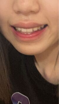 笑った時の口の形がコンプレックスです おかしいですか Yahoo 知恵袋