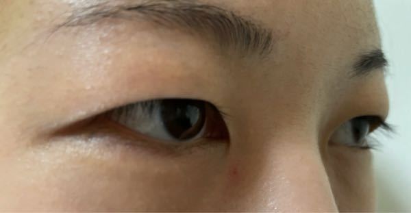 二重マッサージって効果ありますか 私はとても重い一重で 今までマッサー Yahoo 知恵袋