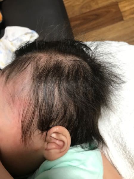 子供 赤ちゃんのころから白髪って生えますか うちの子１歳なんですが さっき Yahoo 知恵袋