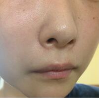 この肌どうしたら綺麗になりますか 女です Yahoo 知恵袋