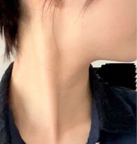 助けてください 胸鎖乳突筋 がめっちゃ痛いです 多分原因は Yahoo 知恵袋