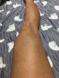 僕は体毛が薄いのですが 男性ホルモンの関係で筋肉がつきにくかったり Yahoo 知恵袋