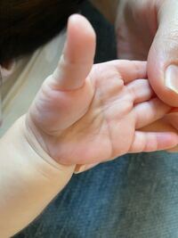 父親の手相がマスカケ 猿線 だと 子供はダウン症 ますかけ線の叔父 Yahoo 知恵袋