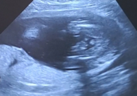 現在妊娠17週目 ５ヶ月 です 先日検診で動画を撮らせていた Yahoo 知恵袋