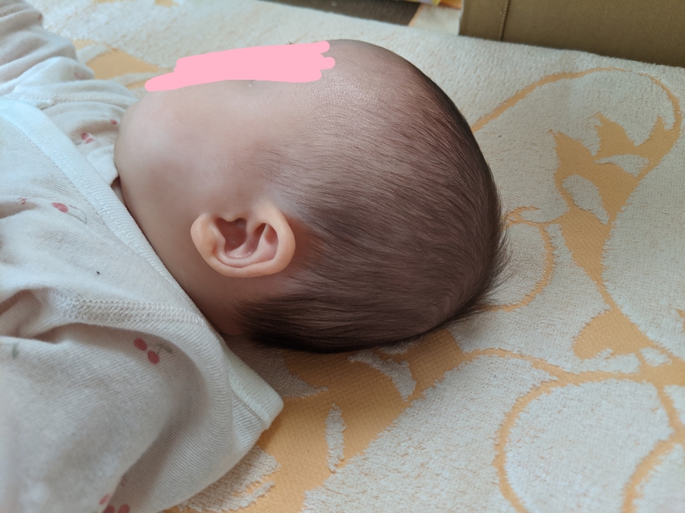 赤ちゃんの頭の形を整えるにはどうしたら良いのでしょうか？生後3ヵ月になる女... Yahoo!知恵袋