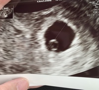 教えてください 今日で妊娠6週目です 今日病院だったのですが まだ心拍は確認 Yahoo 知恵袋