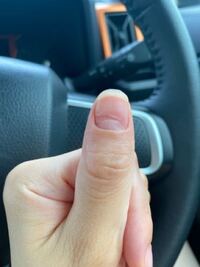 カルジェルとパラジェルの違いを教えてください 先日初めてジェルネイルをして Yahoo 知恵袋