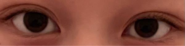 めやにが一日中ずっとでてて 寝て起きた時めやにが固まって目が開 Yahoo 知恵袋