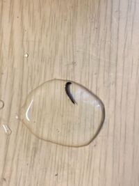 亀の水槽にいたのですがこれはなんですか 黒くて動いていて気持ちが悪いで Yahoo 知恵袋