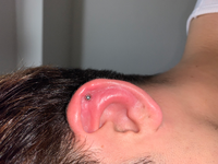 軟骨ピアスを開けて3日ほど前から腫れだして膿が酷いんですがどうした Yahoo 知恵袋