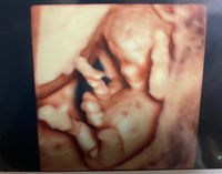 11週目の妊婦です 先日の検診で4dエコーの写真を頂いたのですが Yahoo 知恵袋