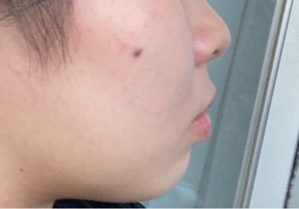 デンタルケア 回答受付中の質問 Yahoo 知恵袋